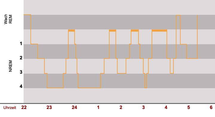 Diagramm für Schlafstadien bei gesundem Schlaf